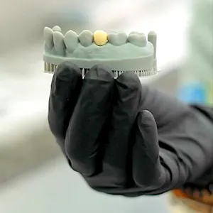 Img-Servicios-Implantes_Dentales